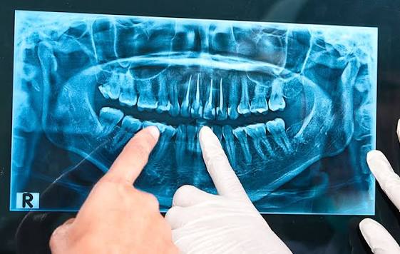 Radiografías dentales