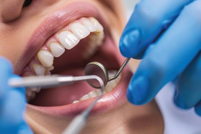 Endodoncia